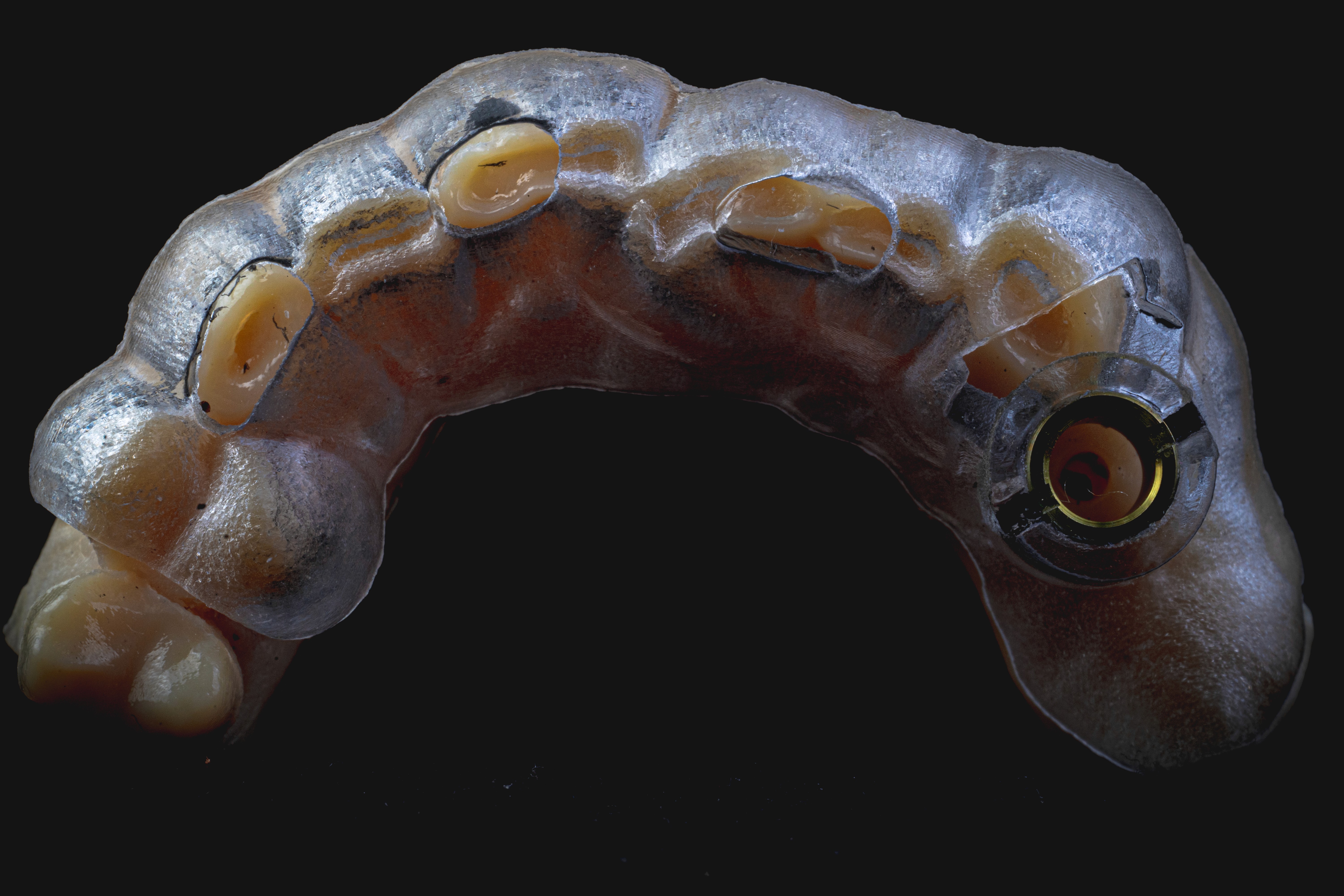 Digital Treatment Planning