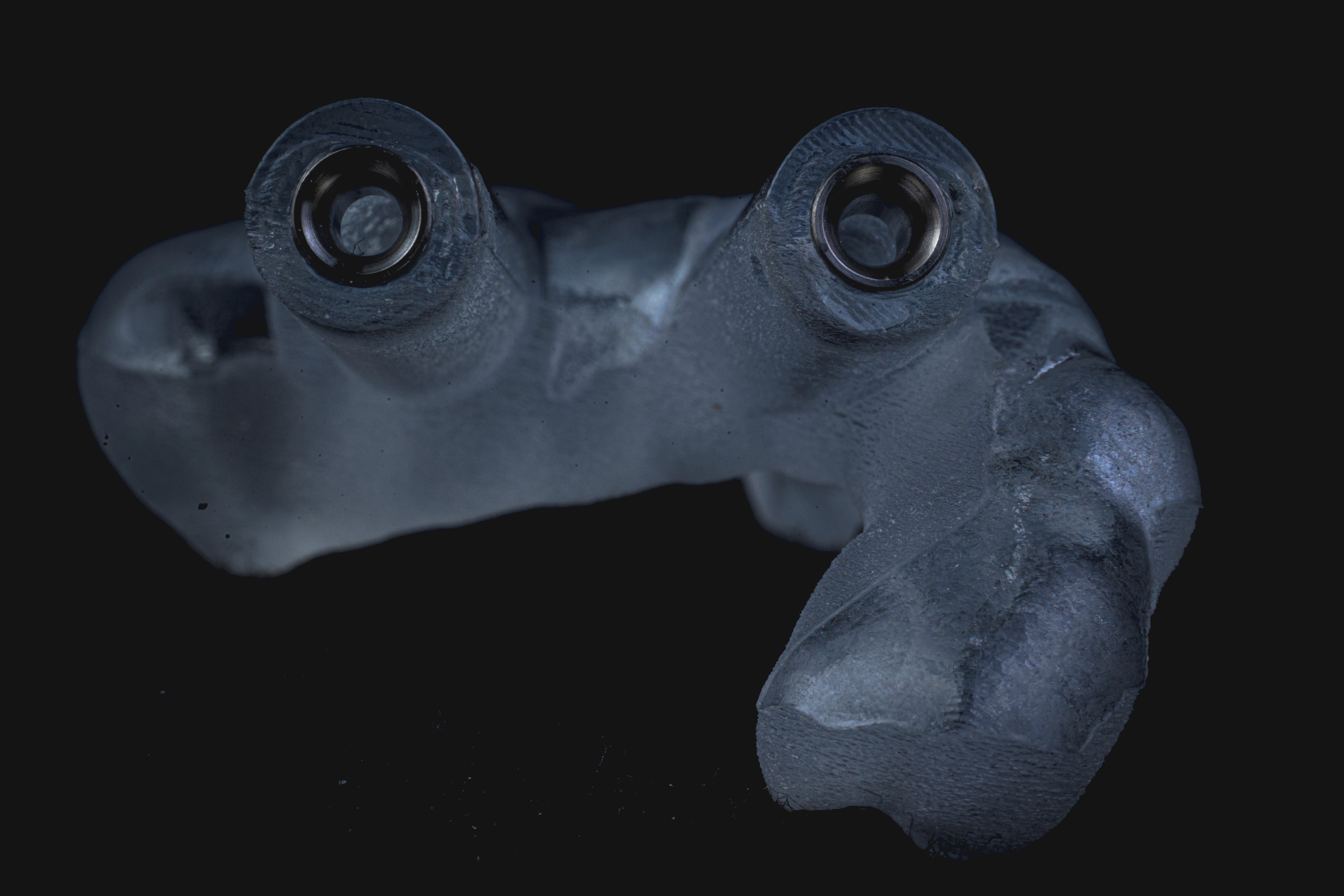 Digital Treatment Planning