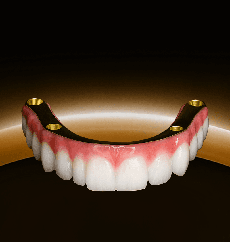 Digital Treatment Planning