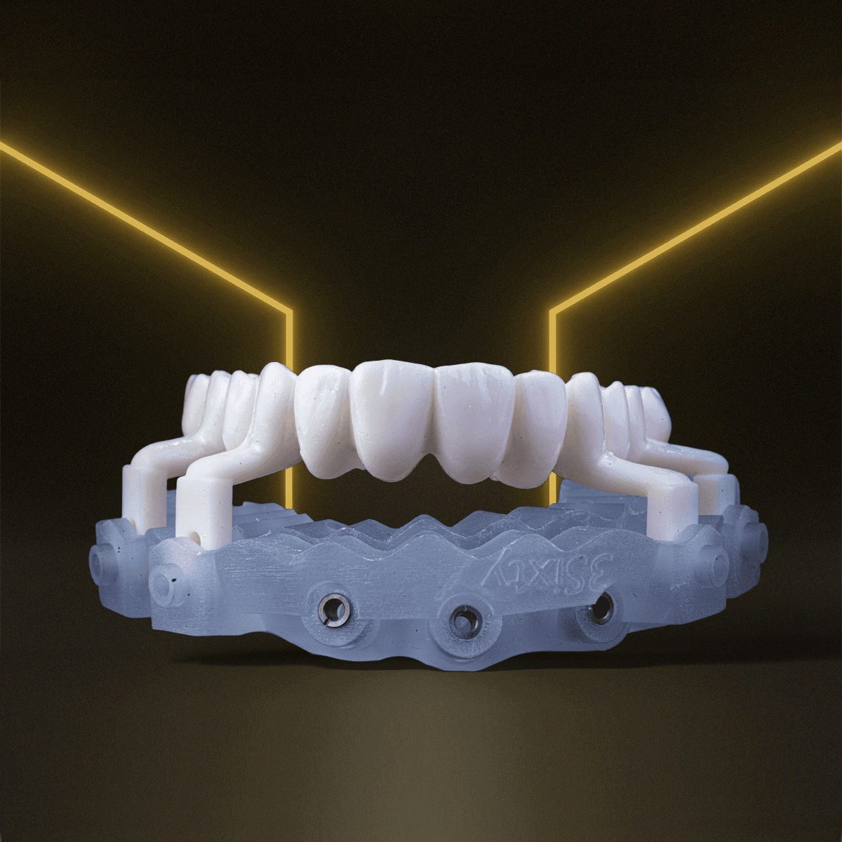 Digital Treatment Planning