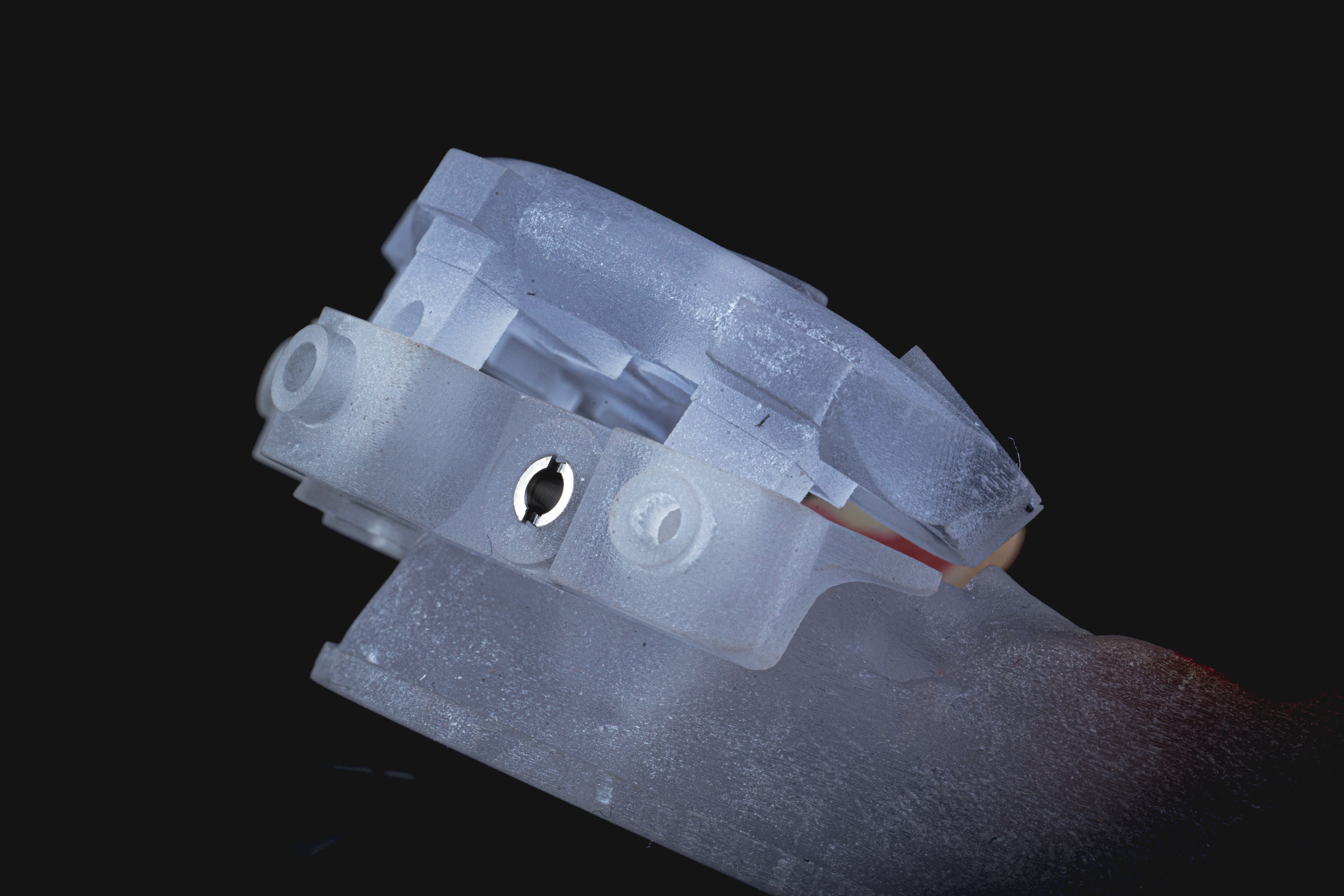 Digital Treatment Planning