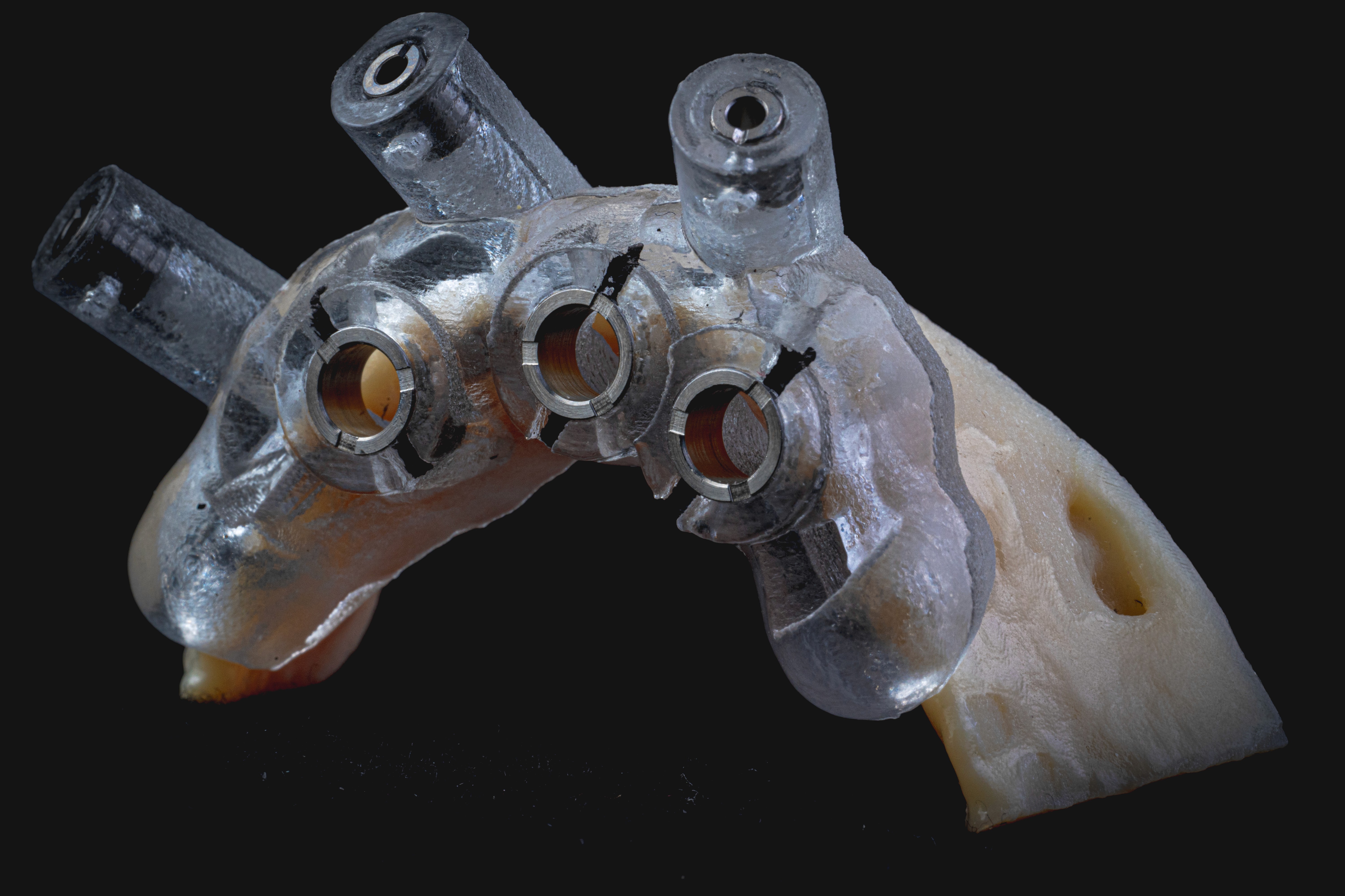 Digital Treatment Planning