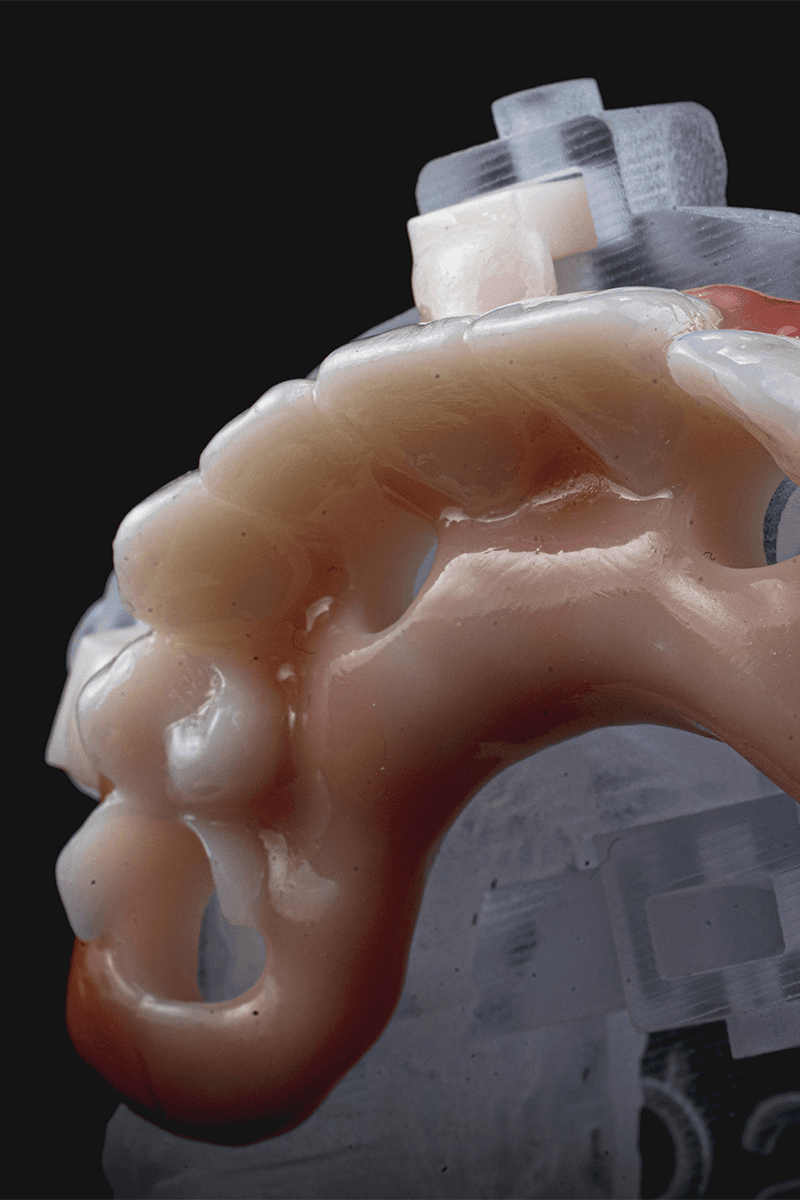 Digital Treatment Planning