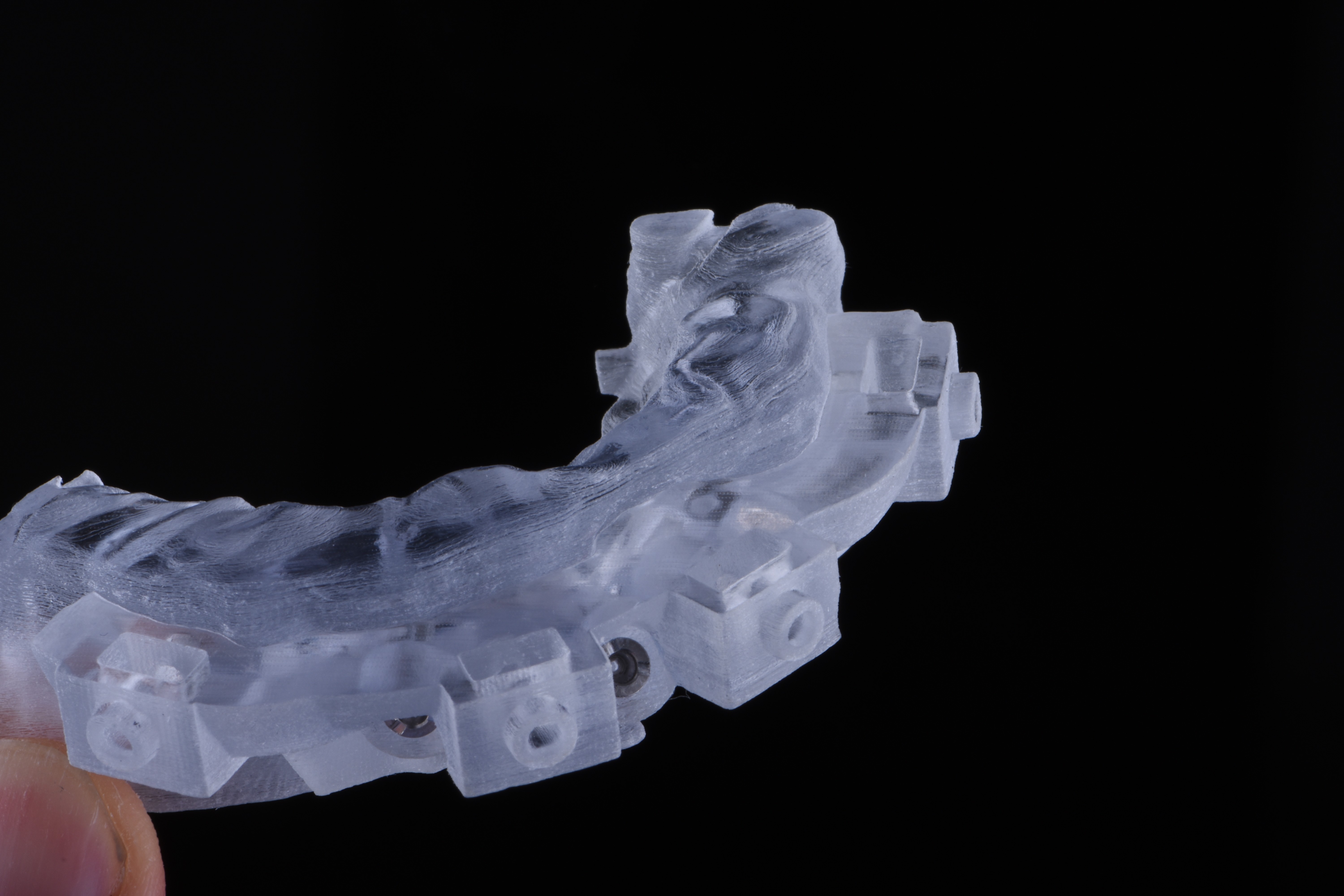 Digital Treatment Planning