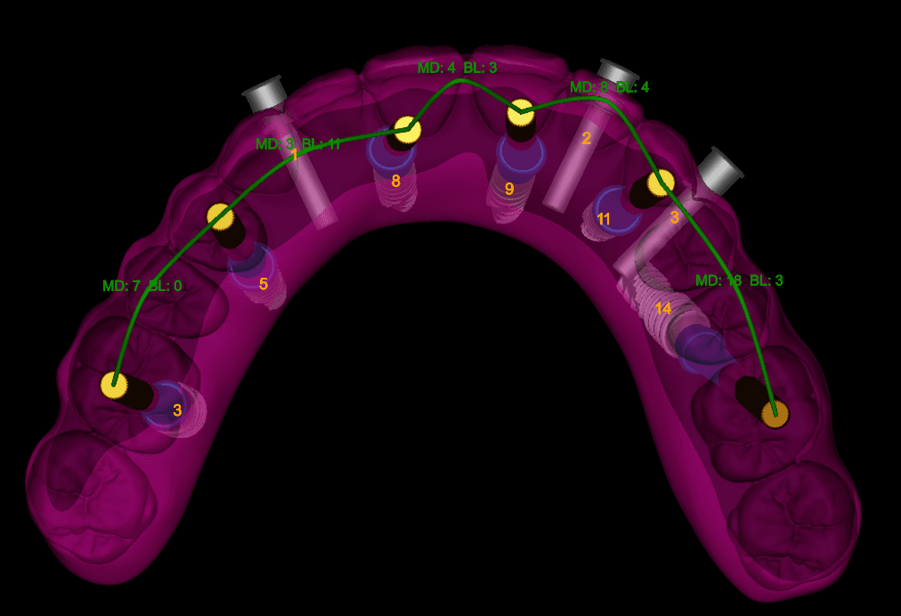 Digital Treatment Planning