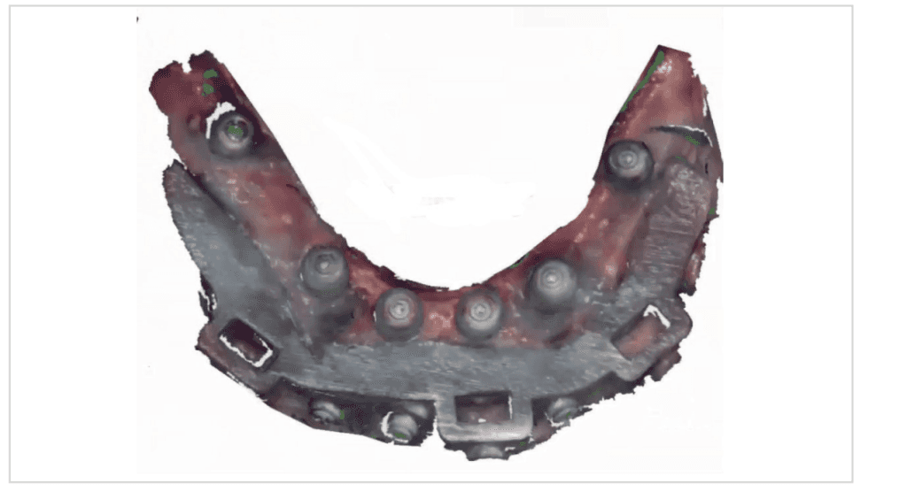 Digital Treatment Planning