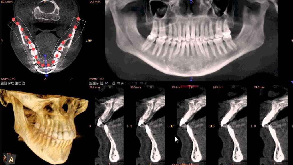 Digital Treatment Planning