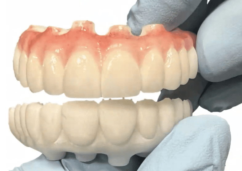 Digital Treatment Planning