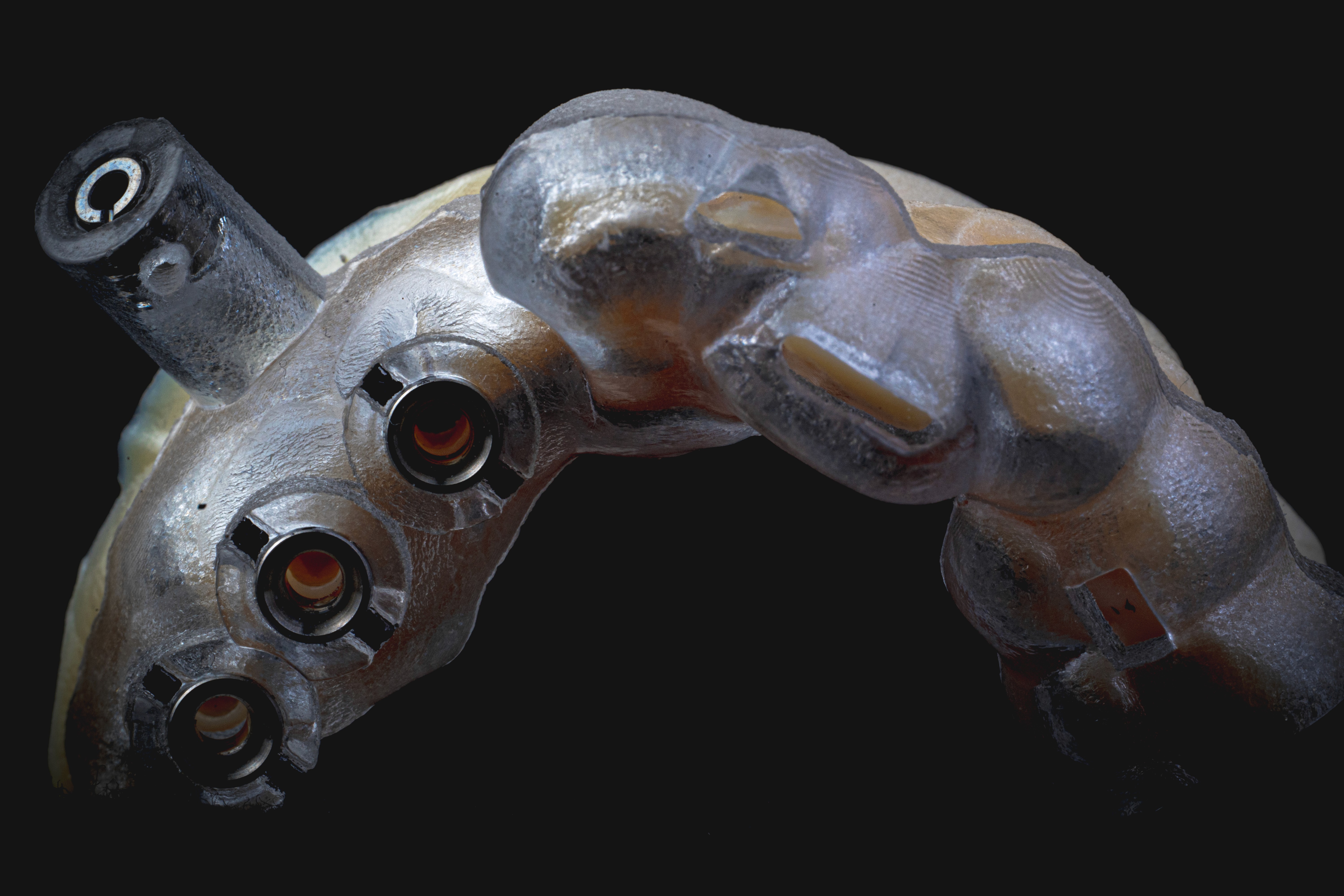 Digital Treatment Planning